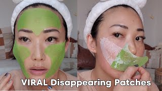 Viral Disappearing Skin Patches [upl. by Tamarah]