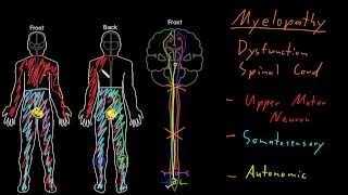 Syndrome Myelopathy [upl. by Nahtanhoj556]