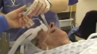 Orotracheal Intubation part2 [upl. by Nannahs]