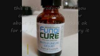 How to Remove Toenail FungusFungi CureToenail Fungus Removal Liquid [upl. by Aillemac679]