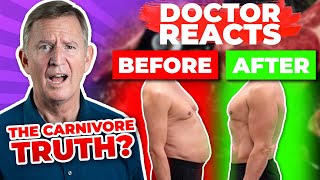 REVIEWING Mark Sisson The Truth About The Carnivore Diet Interview HIGHLIGHTS  Doctor Reacts [upl. by Riplex862]