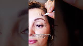 Botox Brow Lift What Is It amp How Does It Work  Dr Elad Azizli [upl. by Genny]