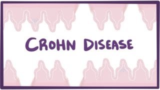 Crohns disease Crohn disease  causes symptoms amp pathology [upl. by Glanti984]