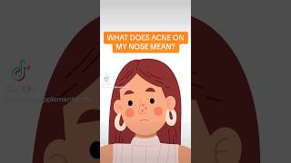 What is the meaning of acne on my nose [upl. by Leschen]