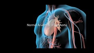 Aortic Aneurysm and Aortic Dissection [upl. by Harli]