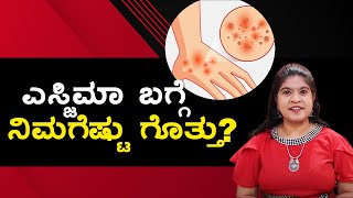 Eczema Symptoms amp treatment  Vijay Karnataka [upl. by Nami]