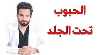 الحبوب تحت الجلد في الوجه العلاج المثالي لا تضيع وقتك في حلول اخرى  دكتور طلال [upl. by Earas]