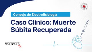 ELECTROFISIOLOGÍA  Caso Clínico  Muerte súbita recuperada SOPECARDTV [upl. by Chobot]