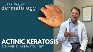 Actinic Keratosis Explained by a Dermatologist  Utah Valley Dermatology [upl. by Ilyk408]