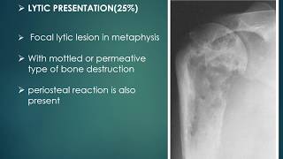 chondroblastoma case presentation with differential diagnosis [upl. by Elconin]