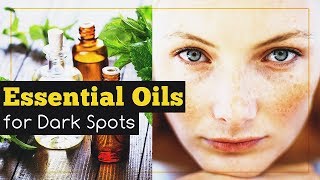 Essential Oils for Dark Spots on Face [upl. by Toille]