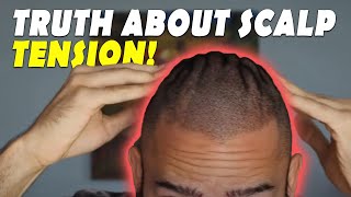 The Truth about Scalp Tension and Scalp Massage for Hair Regrowth [upl. by Ronny218]