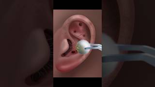 ASMR Ear Cleaning amp Treatment for Ultimate Relaxation asmr satisfying animation tretment [upl. by Godliman]