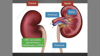 Insuficiencia renal crónica [upl. by Geraldine]