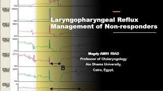 Laryngopharyngeal Reflux Management of Non responders [upl. by Nester]