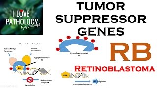 NEOPLASIA 3 TUMOR SUPPRESSOR GENES Retinoblastoma Gene Knudsons Two Hit Hypothesis [upl. by Shirah]