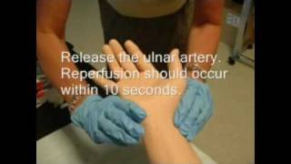 Arterial Blood Gas Sampling Procedure [upl. by Mcclelland]