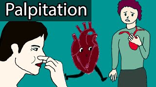 Heart Palpitations  Causes When to worry about heart palpitations [upl. by Allisan]