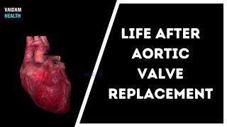 Life After Aortic Valve Replacement [upl. by Sobmalarah]