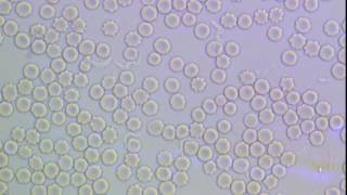 Trypanosoma brucei in mammalian blood [upl. by Skyla867]