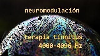 ayuda tinnitus audio terapia neuromodulación 4000 Hz [upl. by Dloreh]