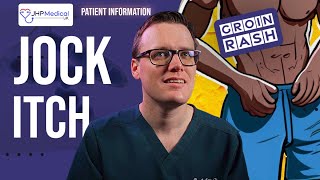 How To Recognise And Treat JOCK ITCH A Doctors Guide With PHOTOS and Home Treatment [upl. by Pearl]