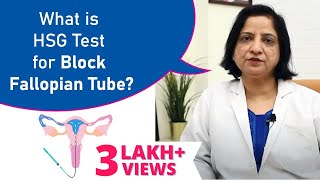 HSG TEST  Kaise Hota hai  HSG Test in Hindi  Prime IVF  Best IVF Hospital in Gurgaon [upl. by Nylesaj]