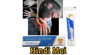 Tofacitinib Gel  Tofarus Gel  use side effects price application etc Vitiligo safeddag [upl. by Dituri595]