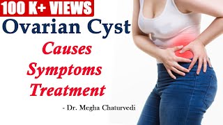 Ovarian Cyst Causes Symptoms and Treatment [upl. by Franciska]