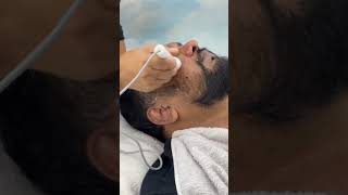 skin analysing with microdermabrasion treatment ⚡headandface1939 youtubeshorts youtube [upl. by Bakeman]