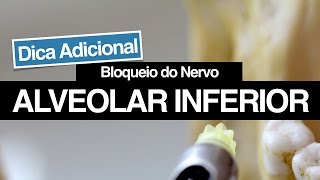 Bloqueio do Nervo Alveolar Inferior  Dicas Adicionais Para Aumentar o seu Sucesso [upl. by Akkim347]