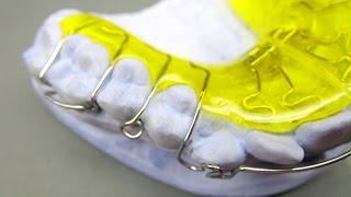 Herstellung einer Dehnplatte KFO Kieferorthopädie Orthodontics active plate Labial Bow Adams clasp [upl. by Aikemehs]