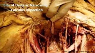 URINARY BLADDER CADAVERIC DISSECTION  Human Anatomy Cadaveric Dissection Videos [upl. by Aynekal329]