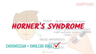 Horners syndrome pathophysiology  Neuroaholics [upl. by Kcyrred586]