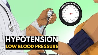 Low Blood Pressure or Hypotension Causes Signs and Symptoms Diagnosis and Treatment [upl. by Einot]