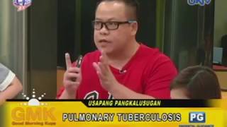 3 Signs of Pulmonary Tuberculosis [upl. by Sig]