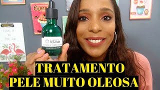 The body shop tea tree oil review how to use it remove acne acne scars with tea tree oil [upl. by Rhianna]