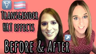 Trans HRT effects MTF Before and After [upl. by Annekim646]