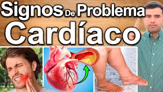 SINTOMAS DE DAÑO CARDIACO O DE CORAZONSignos Que Indican Tienes Daño en el Corazón Debes Conocer [upl. by Osmond330]