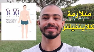 متلازمة كلاينفيلتر اسباب، اعراض، تشخيص، علاج  دواك موجود [upl. by Hesketh]