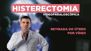 HISTERECTOMIA Videolaparoscópica  RETIRADA do ÚTERO por Vídeo [upl. by Netsoj730]