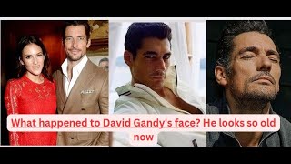 What happened to David Gandys face [upl. by Kariv457]