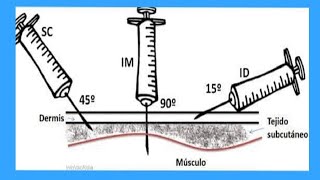 Tutorial  Técnica de administración de vacunas por vía subcutánea Argentina [upl. by Celka]