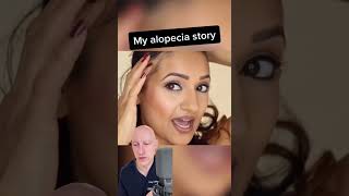 My Alopecia Story [upl. by Rengia]