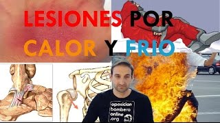 LESIONES POR FRIO Y CALOR  TRAUMATISMOS [upl. by Eilama]