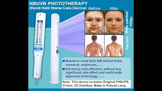 100 Scientificfast Cure of VitiligoPsoriasisEczema using Narrow Band UVB 311nm Phototherapy [upl. by Ierna374]