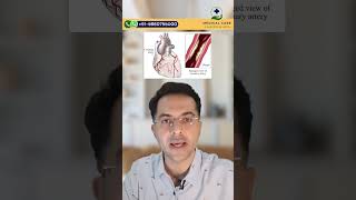 What is CABG Surgery   CABG Surgery in India [upl. by Aloap510]