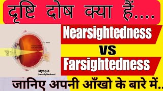 Nearsightedness VS Farsightedness Kya hota hai  Myopia vs Hyperopia [upl. by Drud]