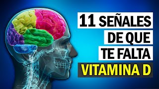 11 Síntomas de que Te Falta Vitamina D ¡CUIDADO [upl. by Randene]