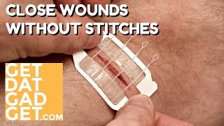 Zipstitch Closes Wounds Without Stitches [upl. by Elicul]